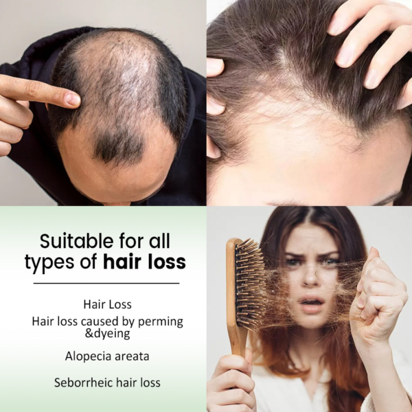 53cd34fc-8ad9-4c13-9511-8b5729460ee4 Rosemary Shampoo
