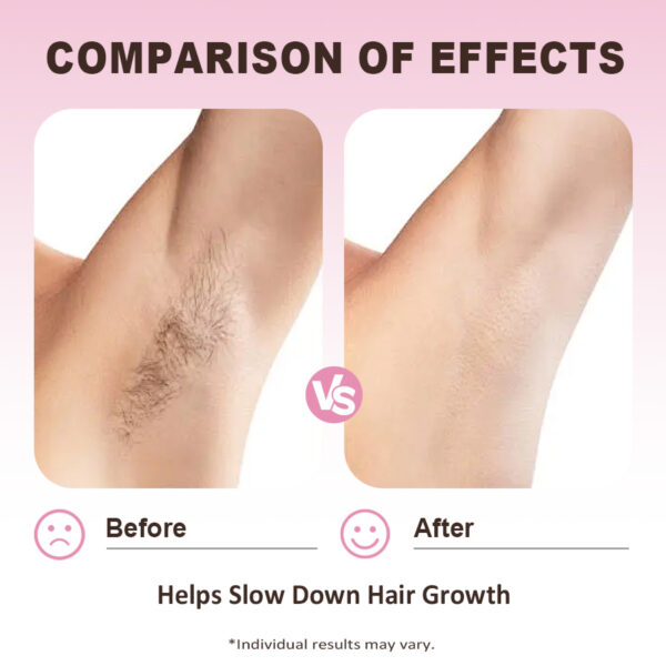 Hair Inhibitor Oil